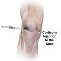 image Cortisone is to reduce inflammation