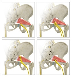 nerve pass