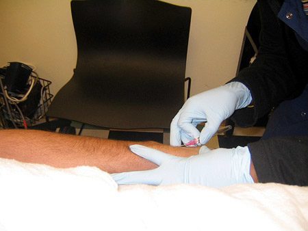 Inserting the IV catheter 