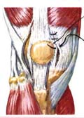 image lateral release medial  repair